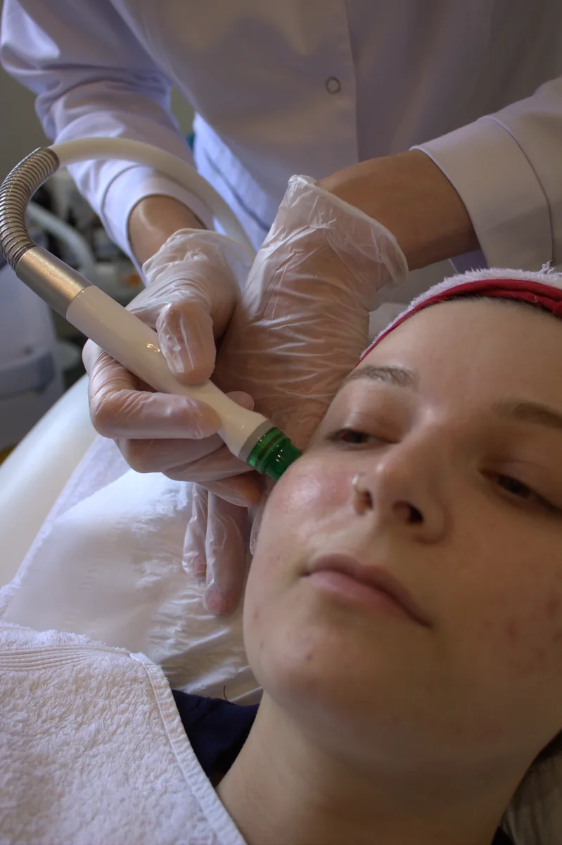 IPL treatment on the arm