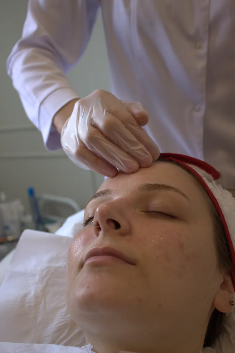 IPL skin treatment on the face